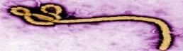 dominio-ebola.com-e-vendido-por-us-200.000